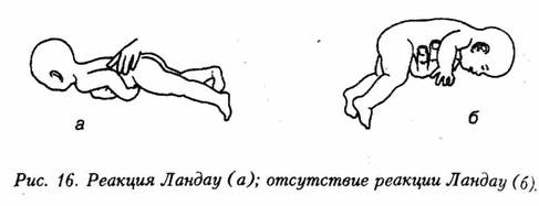 image11 - Искусство не стареть. Как вернуть гибкость и здоровье