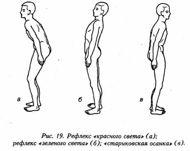 image13 - Искусство не стареть. Как вернуть гибкость и здоровье