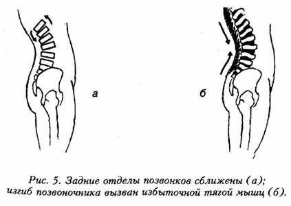 image4 - Искусство не стареть. Как вернуть гибкость и здоровье