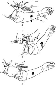 b7d3ec0222 - Первая (доврачебная) помощь при ранениях