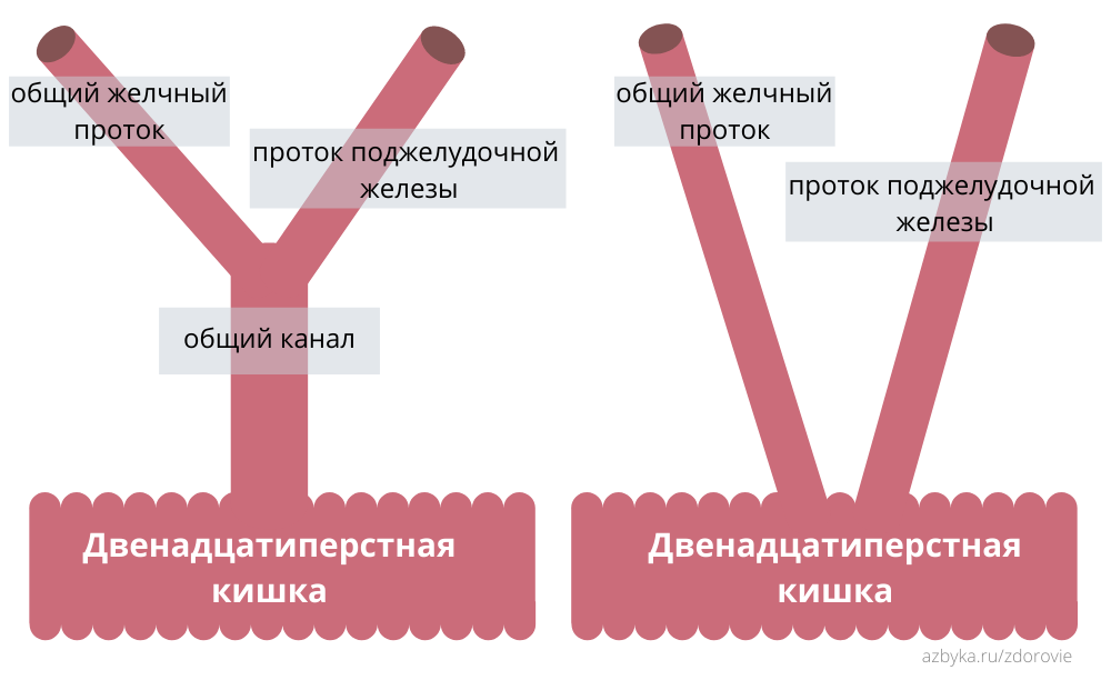 Общие каналы. Теория общего канала. Теория общего канала при панкреатите. Теория общего канала опие. Отличие поджелудочной от предстательной железы.