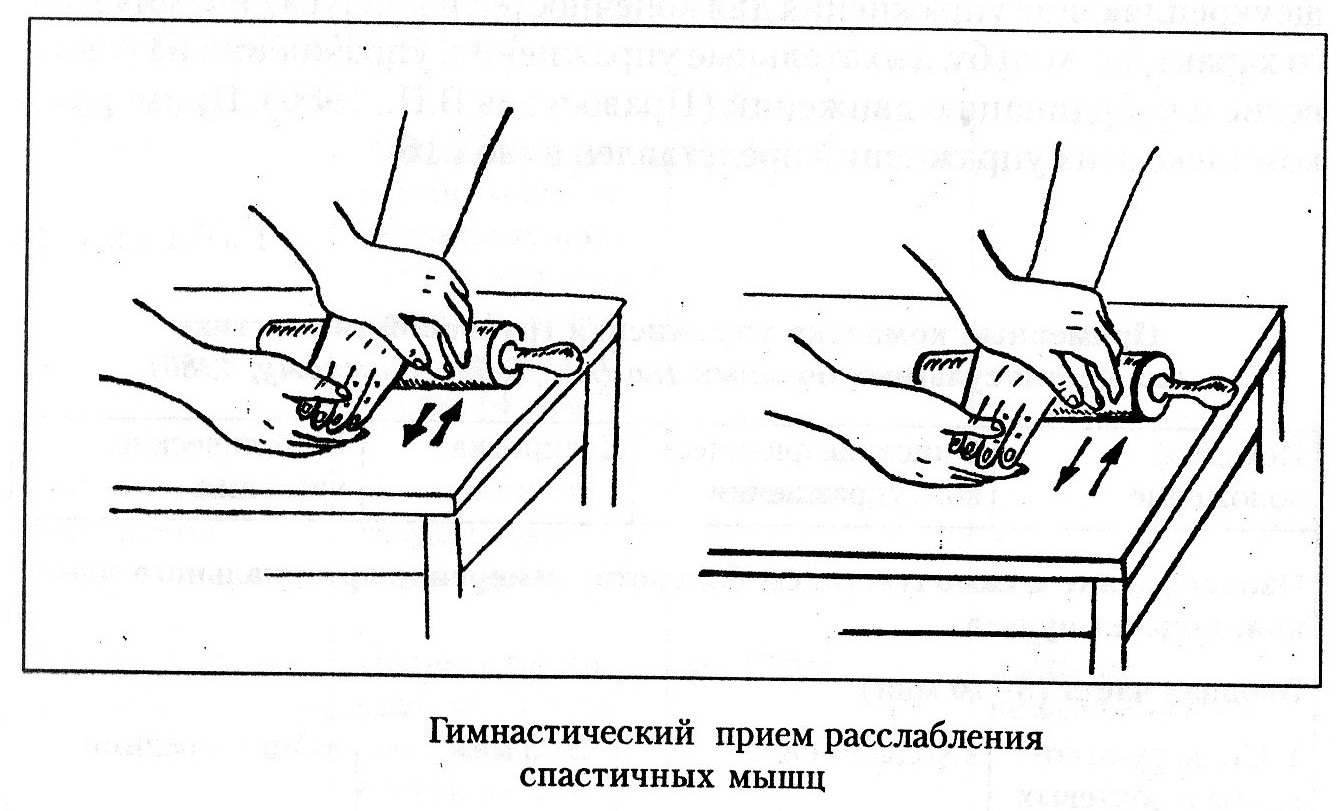 Как научиться вставать после инсульта с кровати