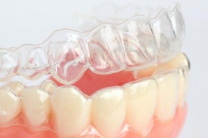 Выравнивание зубов противопоказания к thumbnail