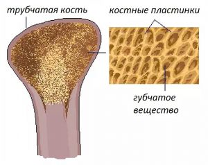 image005 2 - Остеопороз: симптомы, лечение, профилактика