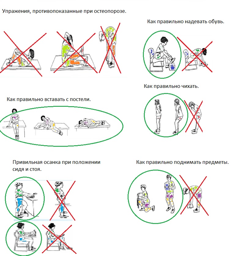 Упражнения при остеопорозе. Упражнения для профилактики остеопороза. ЛФК при остеопорозе для пожилых. Упражнения для спины при остеопорозе для пожилых. Движения, противопоказанные при остеопорозе.
