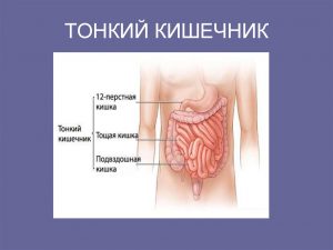 slide 18 - Отчего бывает метеоризм или синдром избыточного бактериального роста (СИБР)?