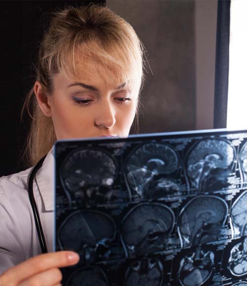 Потеря памяти после COVID-19