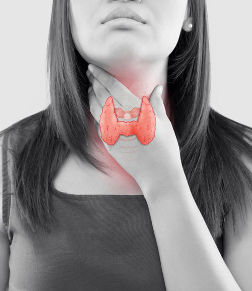 История болезни: рак щитовидной железы